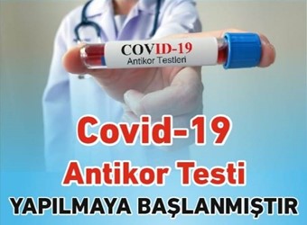 COVİD-19 ANTİKOR TESTİ